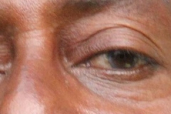 auge3